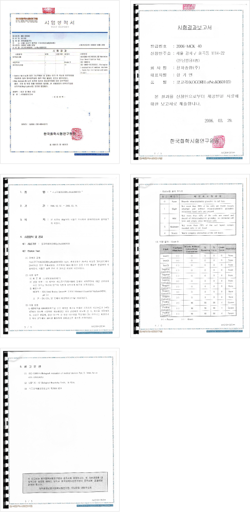 기술평가